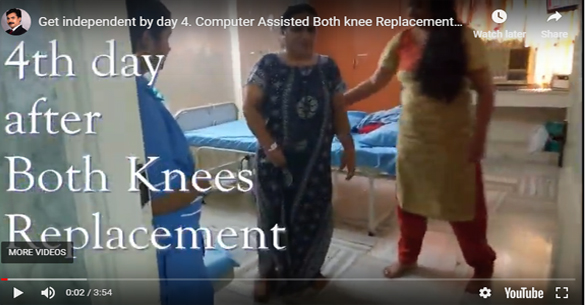 Total Independence by Day 4. Same day Both knee Replacement.